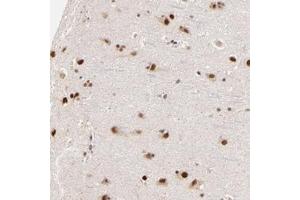 Immunohistochemical staining of human cerebral cortex with ZNF670 polyclonal antibody  shows strong nuclear positivity in neuronal cells and glial cells at 1:50-1:200 dilution.