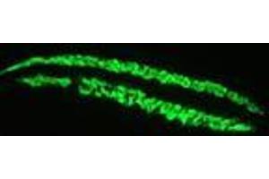 Image no. 1 for anti-Actin, Alpha, Cardiac Muscle 1 (ACTC1) antibody (ABIN959519) (ACTC1 antibody)