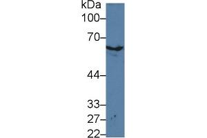 Western Blot; Sample: Mouse Skin lysate; Primary Ab: 3µg/ml Rabbit Anti-Mouse KRT2 Antibody Second Ab: 0. (Keratin 2 antibody  (AA 200-508))