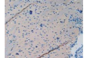 IHC-P analysis of Mouse Brain Tissue, with DAB staining. (MAPT antibody  (AA 92-400))