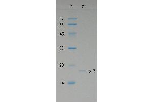 SDS-PAGE (SDS) image for Human Immunodeficiency Virus 1 Matrix (HIV-1 p17) protein (ABIN2452193) (HIV-1 p17 Protein)