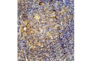 Immunohistochemistry analysis in formalin fixed and paraffin embedded human tonsil tissue reacted with CD10 / Neprilysin Antibody (Center) followed by peroxidase conjugation of the secondary antibody and DAB staining.