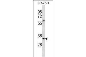 Western blot analysis in ZR-75-1 cell line lysates (35ug/lane). (ING2 antibody  (AA 112-141))