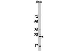 Western blot analysis of CD8A polyclonal antibody  in HeLa cell line lysates (35 ug/lane). (CD8 alpha antibody  (N-Term))
