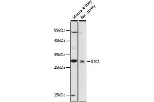 Western blot analysis of extracts of various cell lines, using STC1 antibody (ABIN7270583) at 1:1000 dilution. (Stanniocalcin 1 antibody  (AA 18-247))
