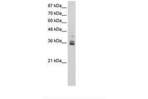 Image no. 1 for anti-Zinc Finger Protein 197 (ZNF197) (N-Term) antibody (ABIN6736240) (ZNF197 antibody  (N-Term))