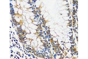 Immunohistochemistry of paraffin-embedded Human colon using CCDC124 Polyclonal Antibody at dilution of 1:100 (40x lens). (CCDC124 antibody)