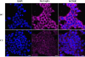 Immunocytochemical staining of HeLa cells using Huntingtin antibody (ABIN7799005), 1:1,000), Top panel: wild-type (WT), Bottom panal: Huntingtin shRNA knockdown (KD).