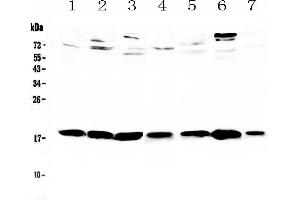 Western blot analysis of HE4 using anti-HE4 antibody . (WFDC2 antibody  (AA 31-168))