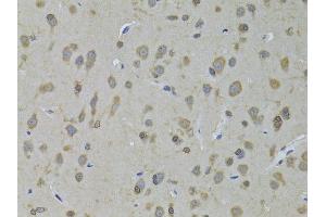 Immunohistochemistry of paraffin-embedded rat brain using ADH5 antibody (ABIN6292597) at dilution of 1:100 (40x lens).