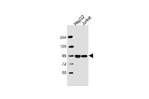 Western Blot at 1:2000 dilution Lane 1: HepG2 whole cell lysate Lane 2: Jurkat whole cell lysate Lysates/proteins at 20 ug per lane. (PPFIBP1 antibody  (AA 588-617))