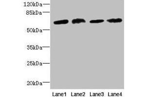 Western blot All lanes: CEP63 antibody at 12 μg/mL Lane 1: K562 whole cell lysate Lane 2: Hela whole cell lysate Lane 3: NIH/3T3 whole cell lysate Lane 4: Raji whole cell lysate Secondary Goat polyclonal to rabbit IgG at 1/10000 dilution Predicted band size: 82, 64, 58, 56 kDa Observed band size: 64 kDa