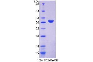 SDS-PAGE (SDS) image for Amphiphysin (AMPH) (AA 24-240) protein (His tag) (ABIN4989064)