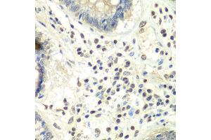 Immunohistochemistry of paraffin-embedded human colon using PRMT5 antibody at dilution of 1:100 (x40 lens). (PRMT5 antibody)