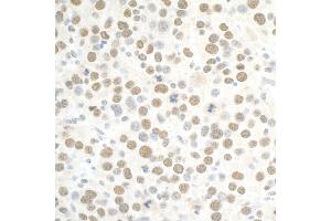 Immunohistochemistry (IHC) image for anti-Polybromo 1 (PBRM1) (AA 1639-1689) antibody (ABIN7453903) (Polybromo 1 antibody  (AA 1639-1689))