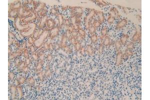 DAB staining on IHC-P; Samples: Mouse Kidney Tissue (PLXNB1 antibody  (AA 1598-1849))