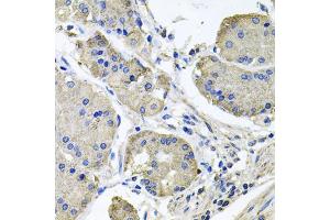 Immunohistochemistry of paraffin-embedded human stomach using NDUFA6 antibody. (NDUFA6 antibody)