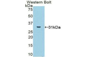 Western Blotting (WB) image for anti-NADPH Oxidase 1 (NOX1) (AA 235-488) antibody (ABIN3208401) (NOX1 antibody  (AA 235-488))