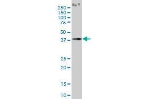 PCYT1A antibody  (AA 2-90)