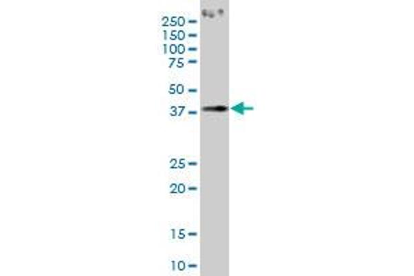 PCYT1A antibody  (AA 2-90)