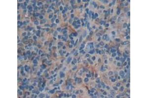 Figure. (BMP8A antibody  (AA 261-399))