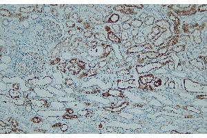 Immunohistochemistry (IHC) image for anti-Napsin A Aspartic Peptidase (NAPSA) (N-Term) antibody (ABIN7598894) (NAPSA antibody  (N-Term))