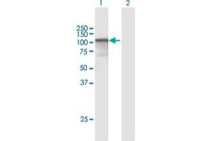 Western Blot analysis of CAST expression in transfected 293T cell line by CAST MaxPab polyclonal antibody. (Calpastatin antibody  (AA 1-686))