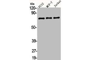 Western Blot analysis of PC12 MCF7 Jurkat cells using AKAP 95 Polyclonal Antibody (AKAP8 antibody  (Internal Region))