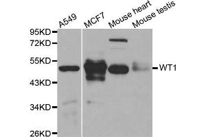 Western blot analysis of extracts of various cell lines, using WT1 antibody. (WT1 antibody)