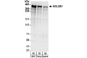 Western Blotting (WB) image for anti-Golgin B1 (GOLGB1) (AA 425-475) antibody (ABIN7450293)