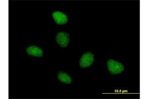 Immunofluorescence of purified MaxPab antibody to TAF15 on HeLa cell. (TAF15 antibody  (AA 1-592))