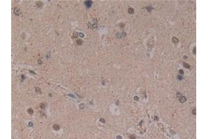 Detection of MFAP2 in Human Brain Tissue using Polyclonal Antibody to Microfibrillar Associated Protein 2 (MFAP2) (MFAP2 antibody  (AA 6-162))