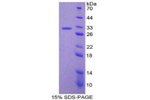 SDS-PAGE (SDS) image for Nucleoporin 37kDa (NUP37) (AA 87-324) protein (His tag) (ABIN2126158)