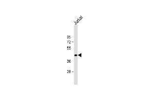 Anti-ST3GAL5 Antibody (C-term) at 1:1000 dilution + Jurkat whole cell lysate Lysates/proteins at 20 μg per lane. (ST3GAL5 antibody  (AA 389-418))