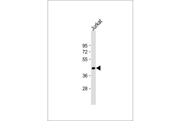 ST3GAL5 antibody  (AA 389-418)