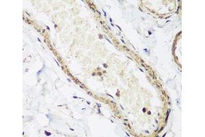 Immunohistochemistry of paraffin-embedded Human colon using CAV3 Polyclonal Antibody at dilution of 1:200 (40x lens). (Caveolin 3 antibody)