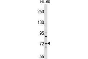 Western blot analysis in HL-60 cell line lysates (35ug/lane) using MTMR6 Antibody (N-term).