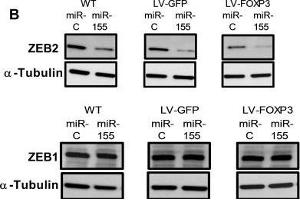 miR-155 and FOXP3 down regulate endogenous ZEB2 in human breast cancer cells resulting in altered levels of EMT markers Vimentin and E-cadherin(A) Relative abundance of ZEB2 and ZEB1 protein in WT, GFP or FOXP3 overexpressing BT549 cells transfected with miR-155 or miR-control. (alpha Tubulin antibody  (Internal Region))