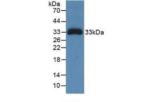 Detection of Recombinant Ceruloplasmin, Human using Monoclonal Antibody to Ceruloplasmin (CP) (Ceruloplasmin antibody  (AA 789-1065))