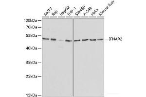 Western blot analysis of extracts of various cell lines using IFNAR2 Polyclonal Antibody at dilution of 1:1000. (IFNAR2 antibody)