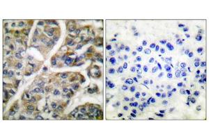 Immunohistochemistry (IHC) image for anti-Granzyme B (GZMB) (N-Term) antibody (ABIN2843546)