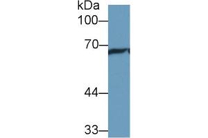 Western blot analysis of Rat Cerebrum lysate, using Rat HSPA1L Antibody (1 µg/ml) and HRP-conjugated Goat Anti-Rabbit antibody ( (HSPA1L antibody  (AA 1-641))
