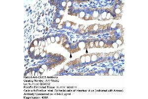 Human Intestine (CLIC5 antibody  (Middle Region))
