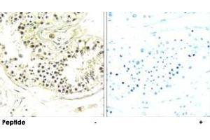 Immunohistochemistry analysis of paraffin-embedded human testis tissue using DYNLRB2 polyclonal antibody .