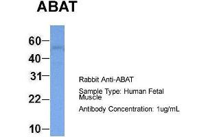 Hum. (ABAT antibody  (Middle Region))