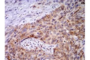 Immunohistochemistry (IHC) image for anti-Progesterone Receptor Membrane Component 1 (PGRMC1) (AA 1-195) antibody (ABIN5873919) (PGRMC1 antibody  (AA 1-195))