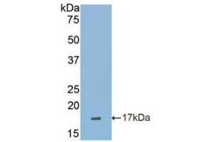 Western blot analysis of recombinant Human SIGLEC7. (SIGLEC7 antibody  (AA 38-121))