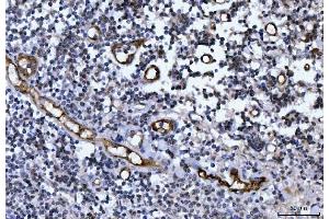IHC analysis of Von Willebrand Factor/VWF using anti-Von Willebrand Factor/VWF antibody (ABIN7599909).