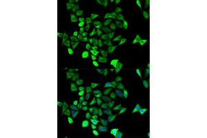 Immunofluorescence analysis of HeLa cell using KCNN4 antibody. (KCNN4 antibody  (AA 288-427))