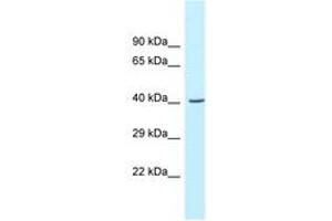 Image no. 1 for anti-Glycine C-Acetyltransferase (GCAT) (AA 219-268) antibody (ABIN6747617) (GCAT antibody  (AA 219-268))